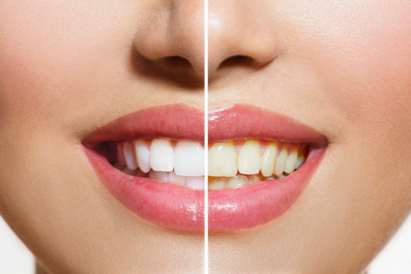 homepage-in1 dentist roxburgh park