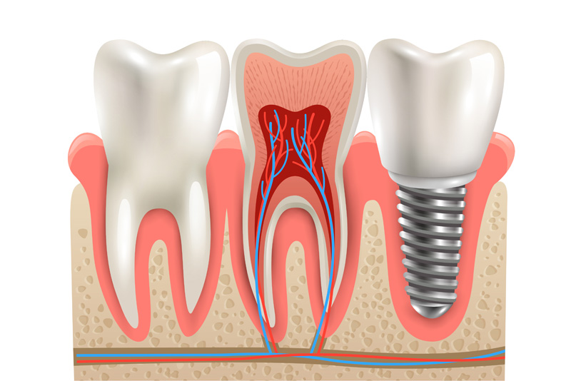 page-in1 dentist roxburgh park