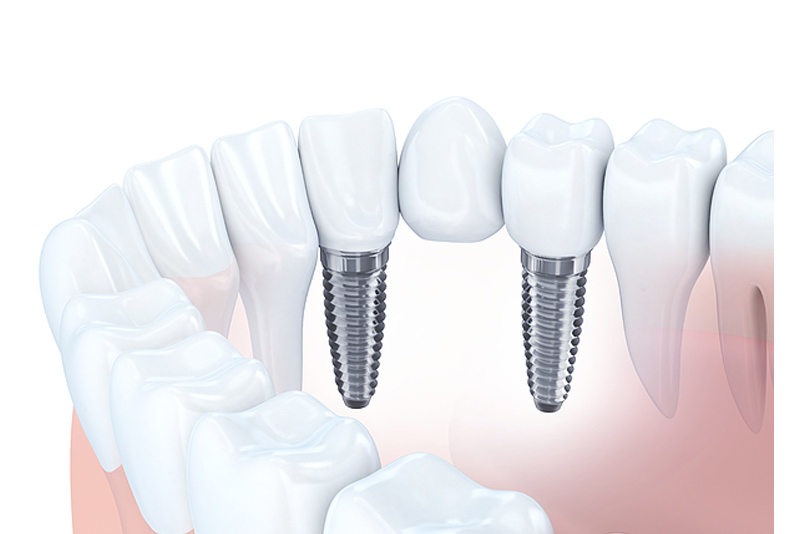 page-image 25 dentist roxburgh park