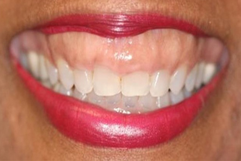 dentist roxburgh park