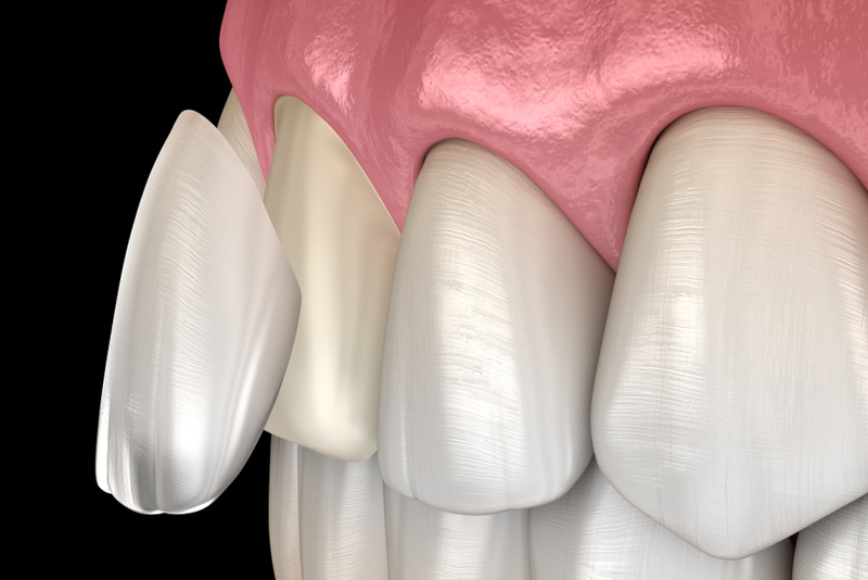 page-in30 cosmetic dentistry roxburgh park