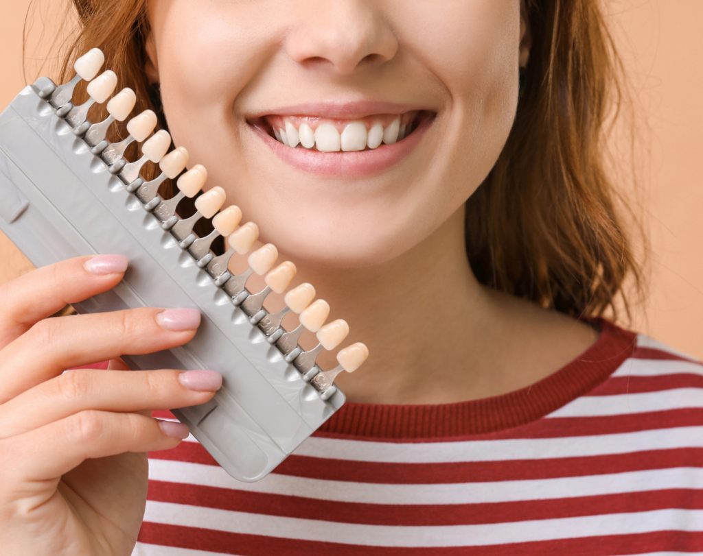 Dental-Veneers-Roxburgh-Park
