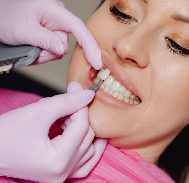 dental veneers roxburgh park dental-veneers-roxburgh-park.