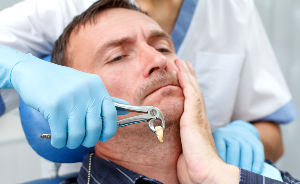 tooth extraction in Roxburgh Park